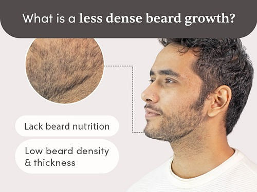 Man Matters Beardmax Growth Serum, Minoxidil 5% | Grocsy