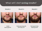 Man Matters Beardmax Growth Serum, Minoxidil 5% | Grocsy