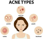 Ipca Acne UV Gel SPF 50 | Grocsy