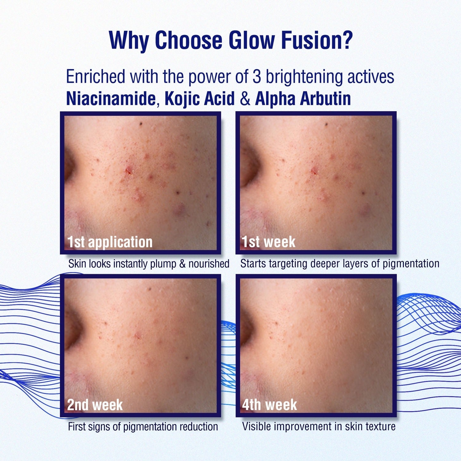 Dermdoc 2% Kojic Acid Night Cream | Grocsy
