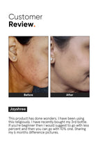 Minimalist 10% Niacinamide Face Serum | Grocsy