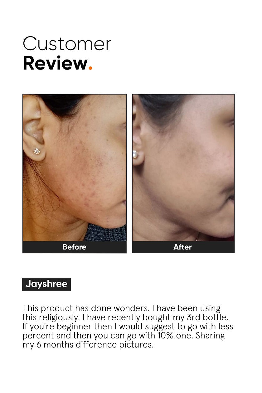 Minimalist 10% Niacinamide Face Serum | Grocsy