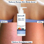 WishCare 10% AHA + 1% BHA Body Lotion for Smooths Rough & Bumpy Skin | Grocsy