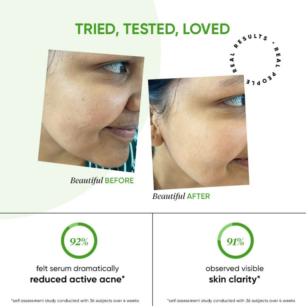Dot & Key 2% Salicylic + Zinc Acne Busting Face Serum For Acne & Oil Control | Grocsy