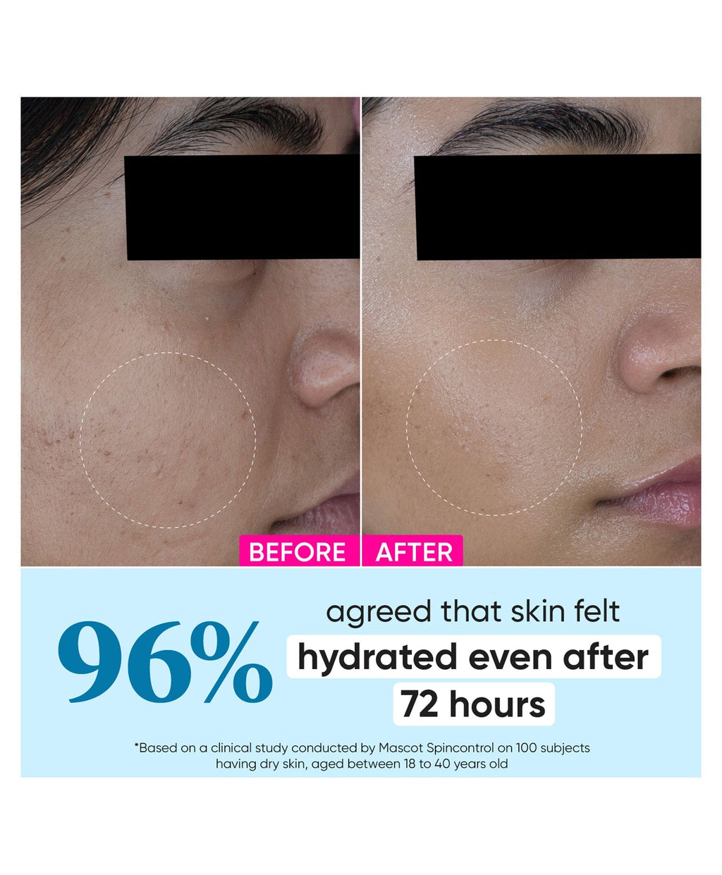Dot & Key 72 Hr Hydrating Probiotic Face Gel With With Hyaluronic Acid, Kombucha & Rice Water | Grocsy