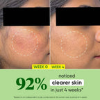 Dot & Key CICA +Niacinamide Oil Free Moisturizer | Grocsy