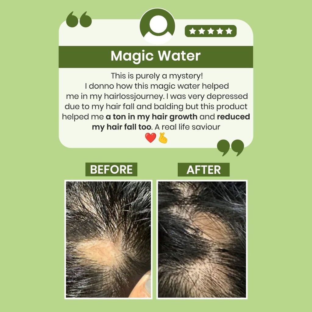 Alps Goodness Rosemary Water for Hair Regrowth | Grocsy
