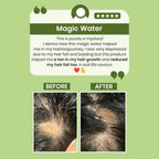 Alps Goodness Rosemary Water for Hair Regrowth | Grocsy