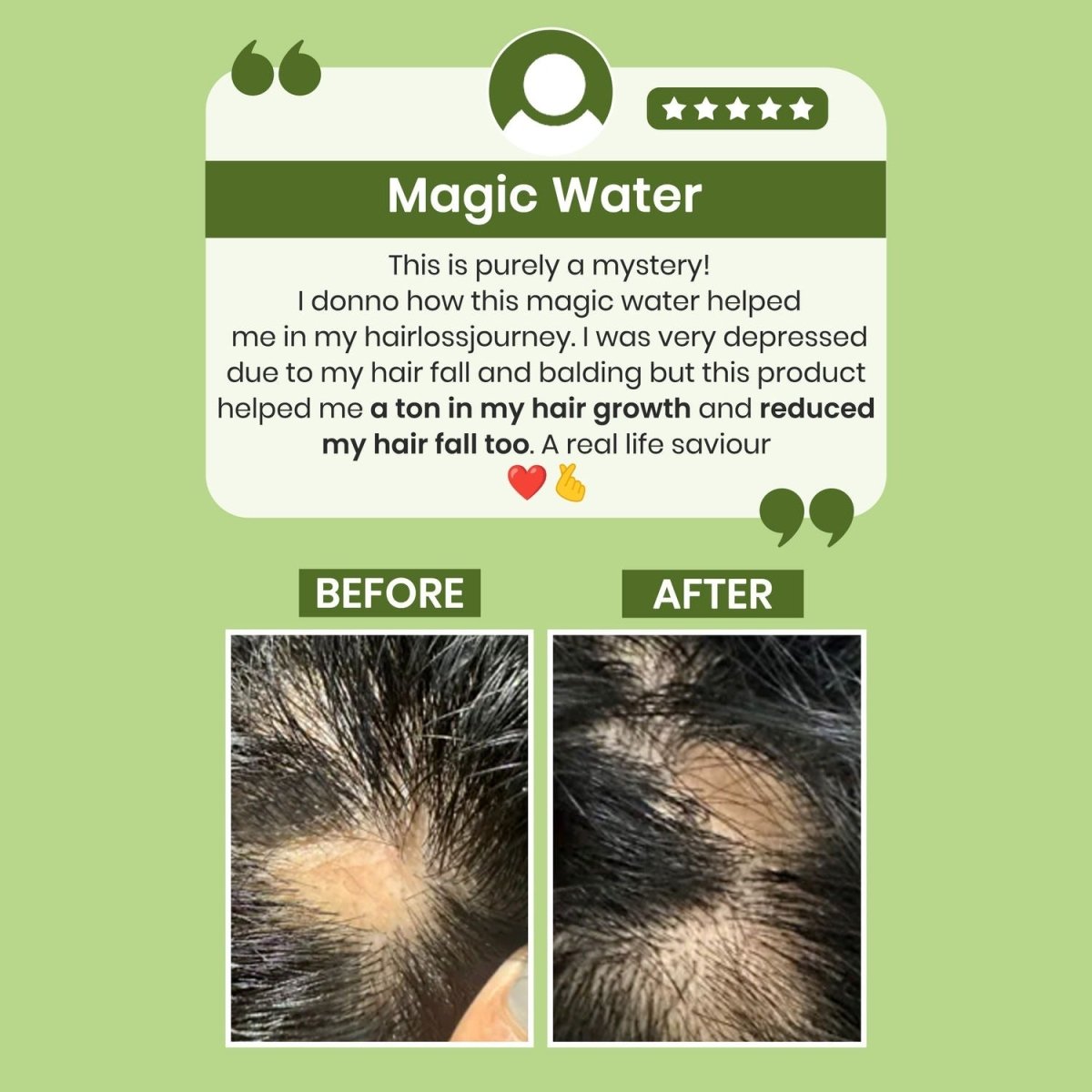 Alps Goodness Rosemary Water for Hair Regrowth | Grocsy