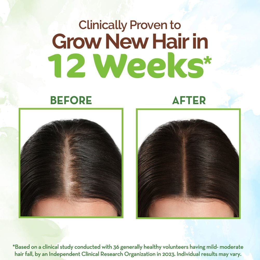 Mamaearth Rosemary Hair Growth Oil with Rosemary & Methi Dana | Grocsy