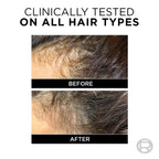 L'Oreal Paris Fall Resist 3X Anti-Hairfall Shampoo | Grocsy