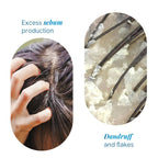 BeBodywise 1% Ketoconazole Dandruff Shampoo For Smooth & Frizz Free Hair | Grocsy