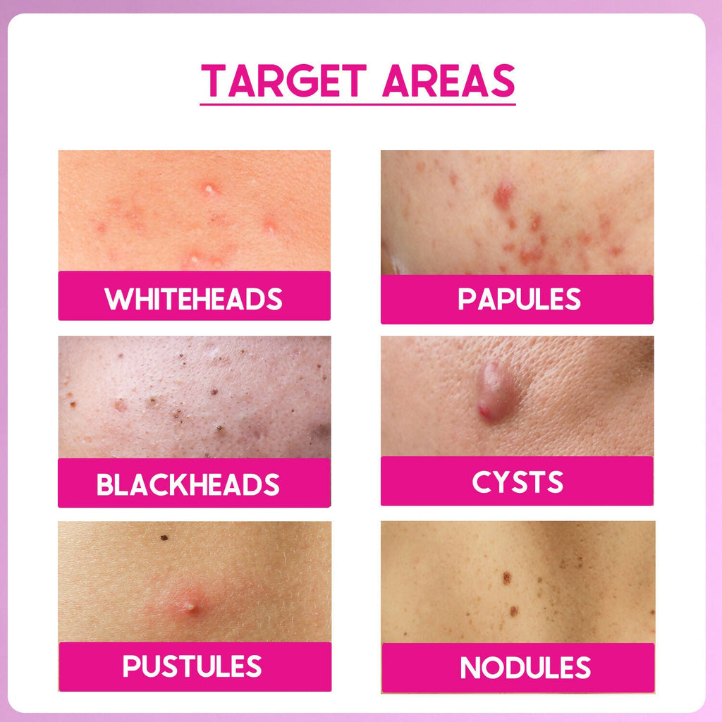 Cos-IQ ABP 11% Beginner Friendly Exfoliating Peel | Grocsy
