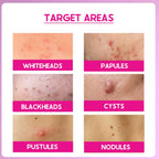 Cos-IQ ABP 11% Beginner Friendly Exfoliating Peel | Grocsy