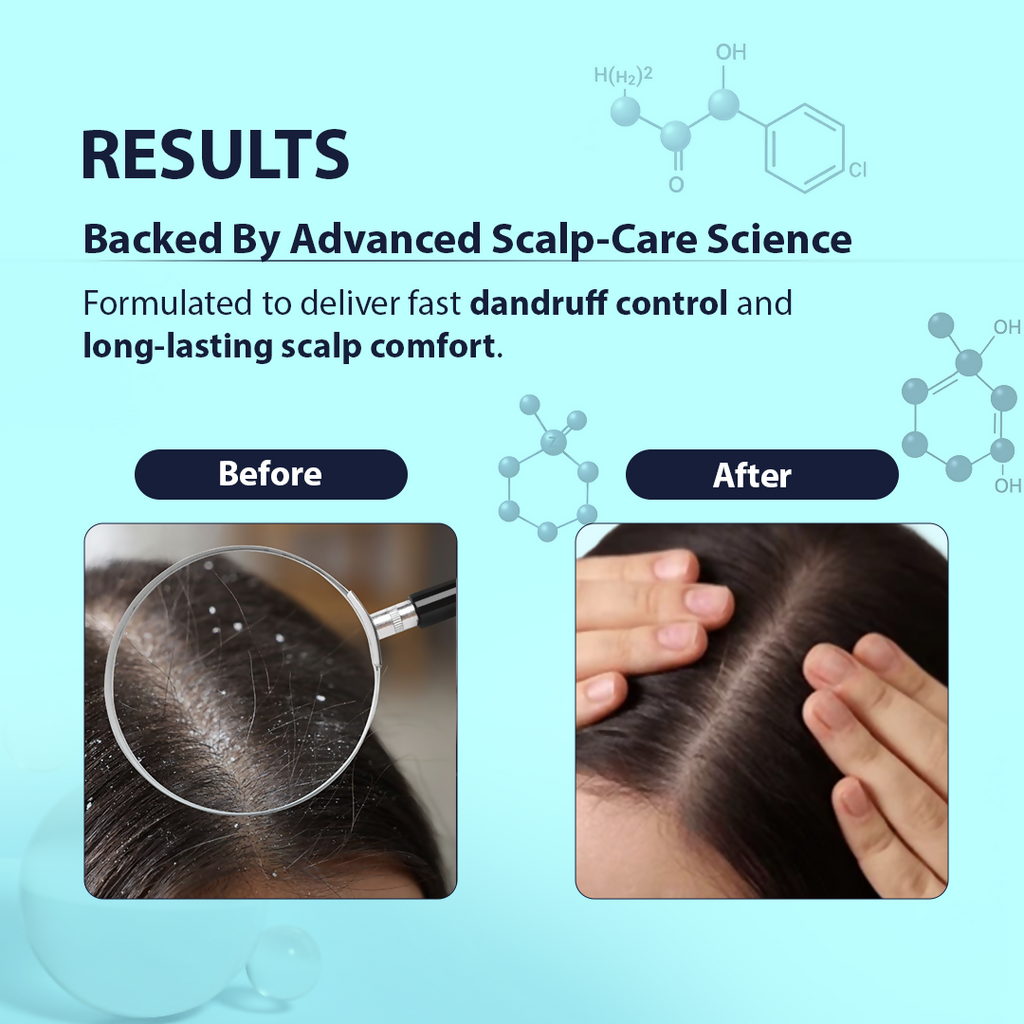 Dermistry Anti-Dandruff Control Shampoo | Grocsy