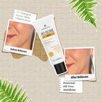 Heliocare 360 Gel Oil-Free Sunscreen SPF 50 Pa++++ Oily & Combination Skin, Anti-Acne, Matte Finish | Grocsy