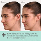 Lotus DermaBotanics Kojic Acid + Multi Berry Blemish-Free Face Wash, pH5.5, For Sensitive Skin | Grocsy