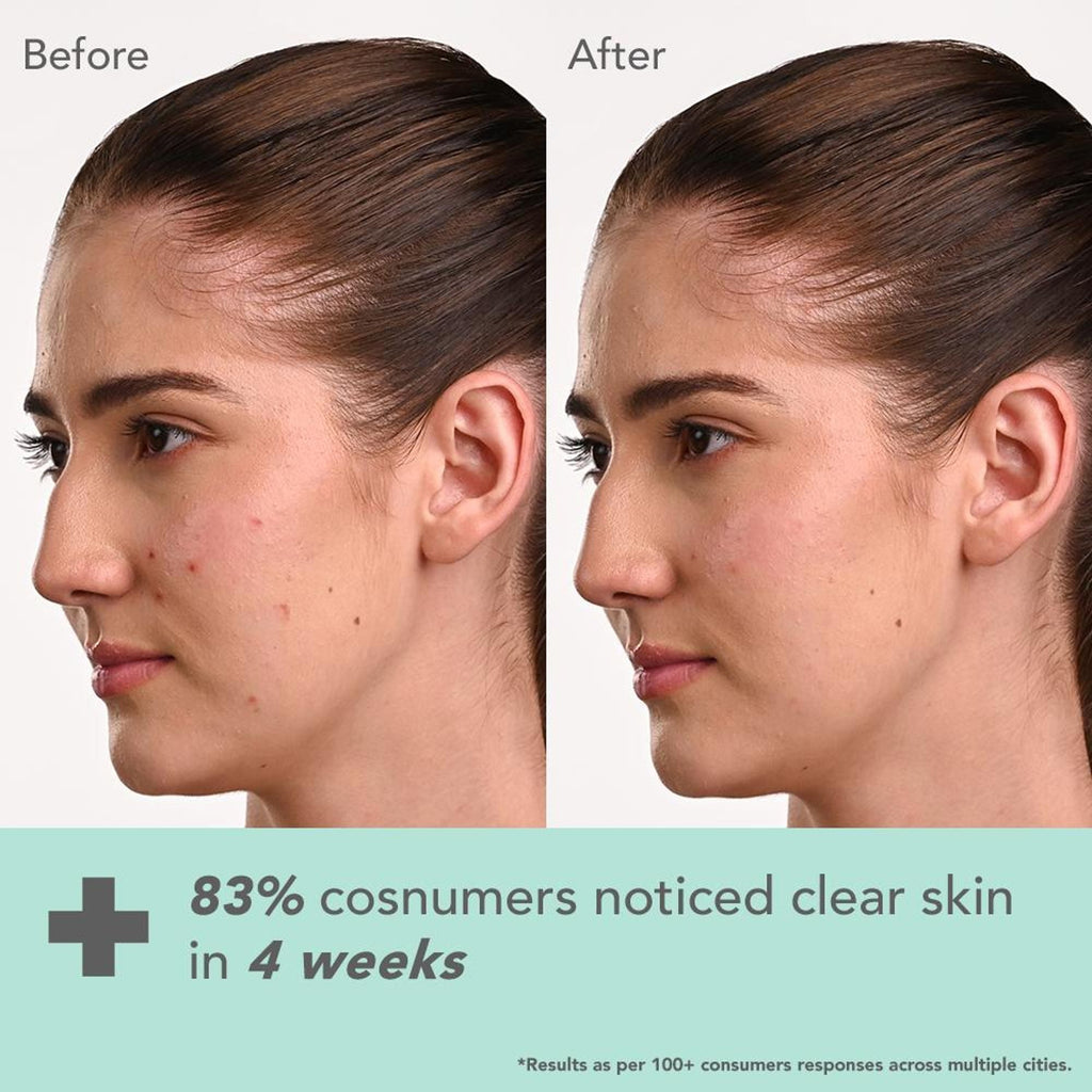 Lotus DermaBotanics Kojic Acid + Multi Berry Ampoule Crème, pH5.5, For Sensitive Skin | Grocsy