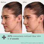 Lotus DermaBotanics Kojic Acid + Multi Berry Ampoule Crème, pH5.5, For Sensitive Skin | Grocsy