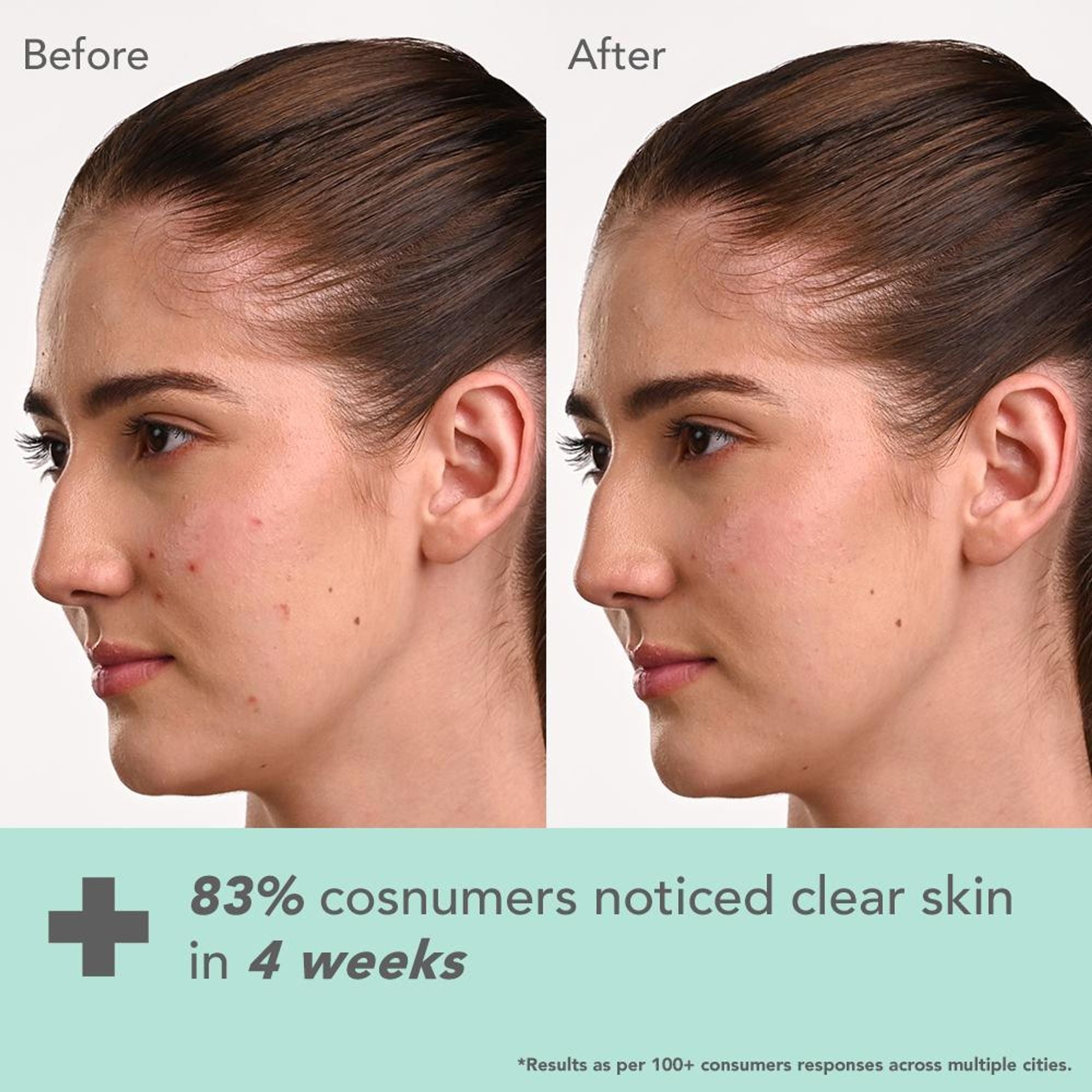 Lotus DermaBotanics Kojic Acid + Multi Berry Ampoule Crème, pH5.5, For Sensitive Skin | Grocsy