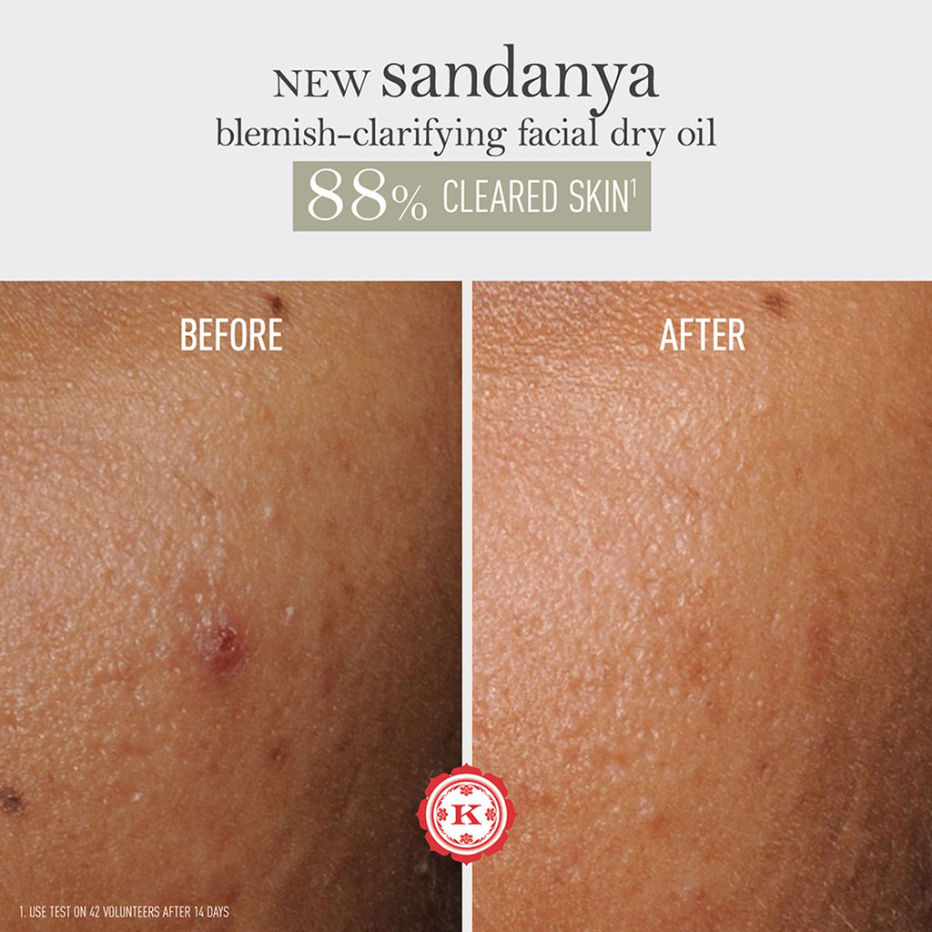 Kama Ayurveda Sandanya Blemish Clarifying Dry Oil | Grocsy