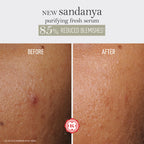 Kama Ayurveda Sandanya Purifying Fresh Serum | Grocsy