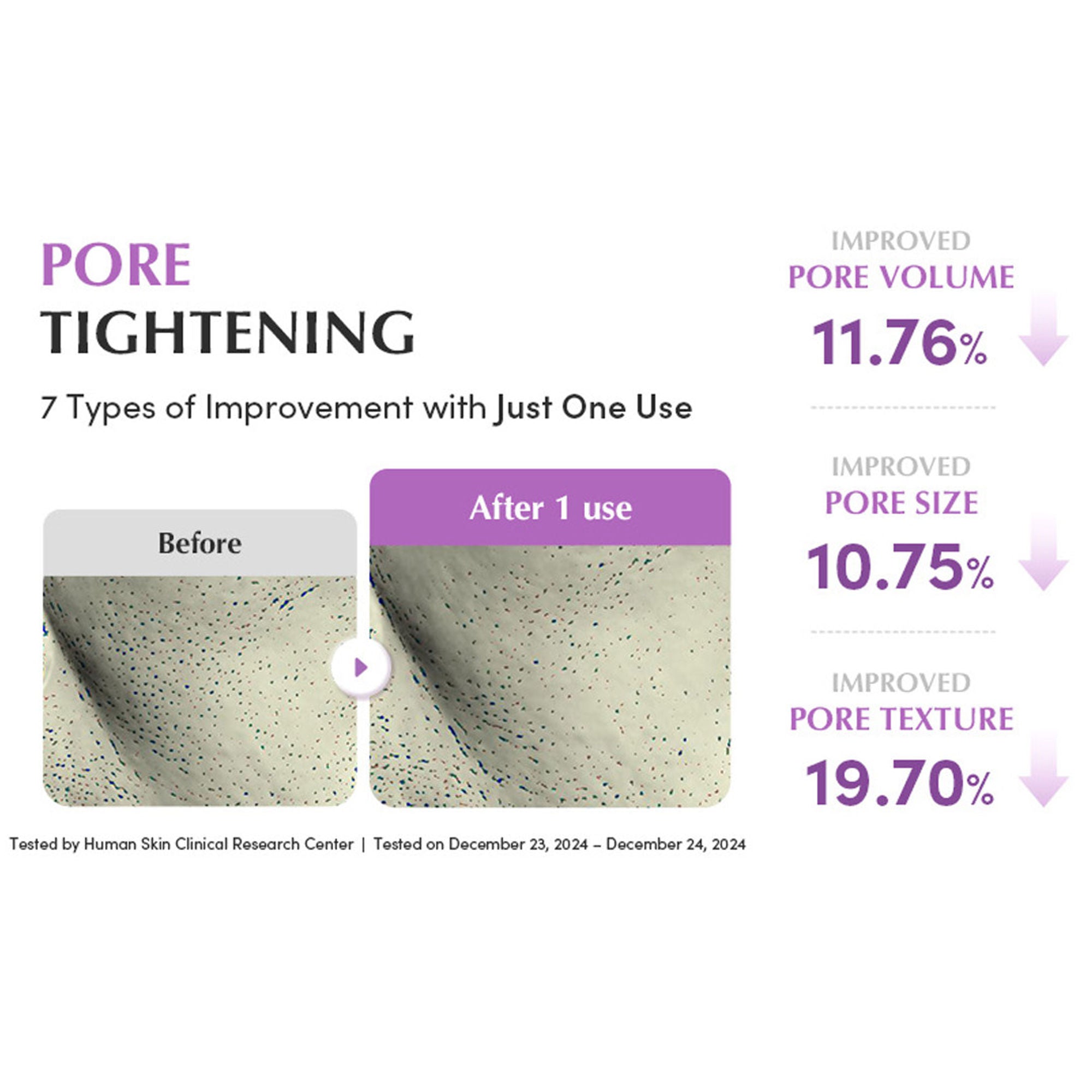 Eqqualberry Purple Rice Pore Purifying Cleanser – Deep Pore Care & Sebum Control | Grocsy
