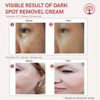 Ivory Natural Dark Spot Removal Face Cream For Dark Spots And Achieve A Glowing Tone | Grocsy