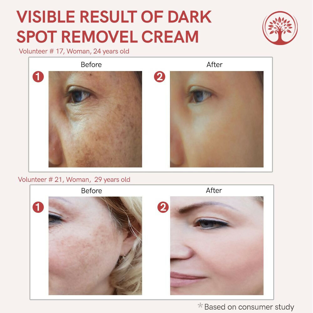 Ivory Natural Dark Spot Removal Face Cream For Dark Spots And Achieve A Glowing Tone | Grocsy