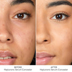 By Terry Hyaluronic Serum Concealer - 4. Rosy Nude | Grocsy