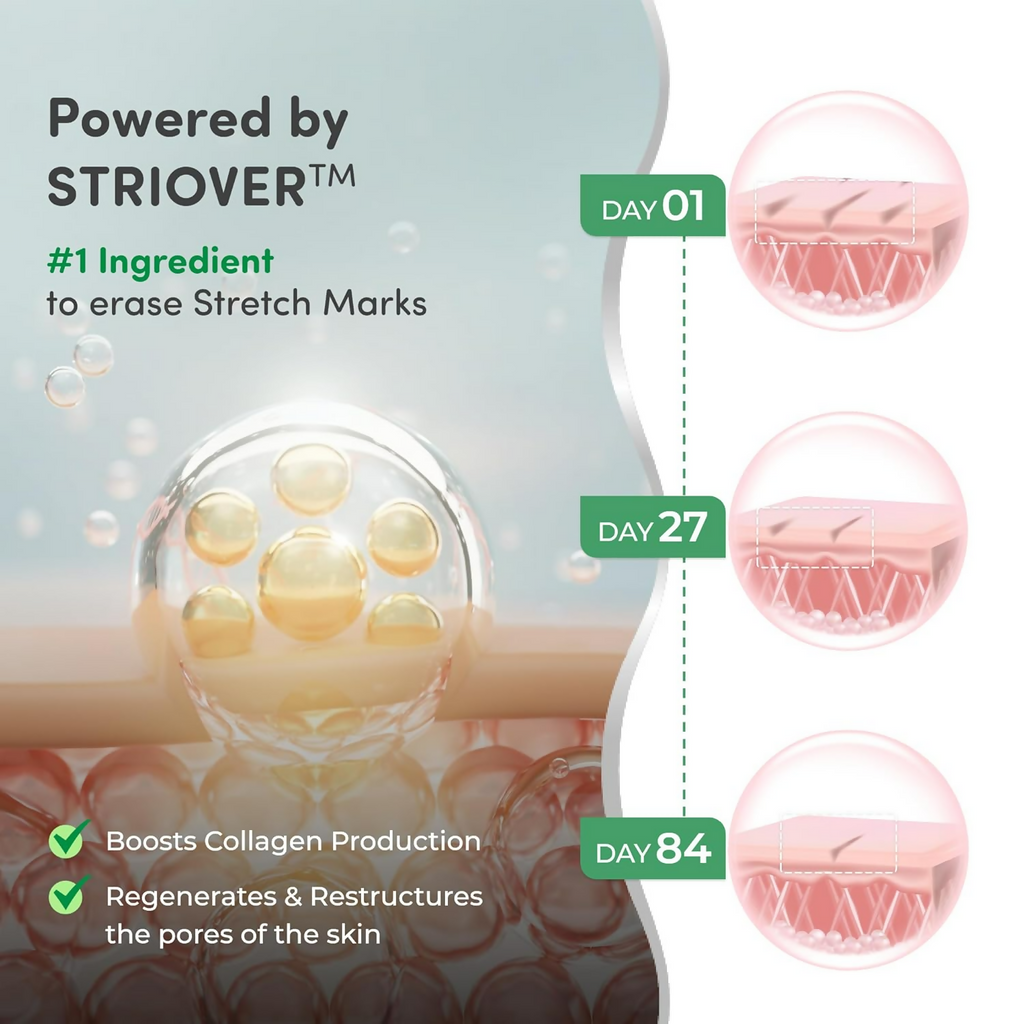 Mylo Care Stretch Marks Combo | Grocsy