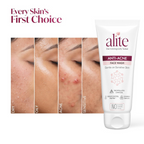 Alite Anti-Acne 5-in-1 Face Wash - Encapsulated Charcoal, Sebum Control Enzyme & Ceramides | Grocsy