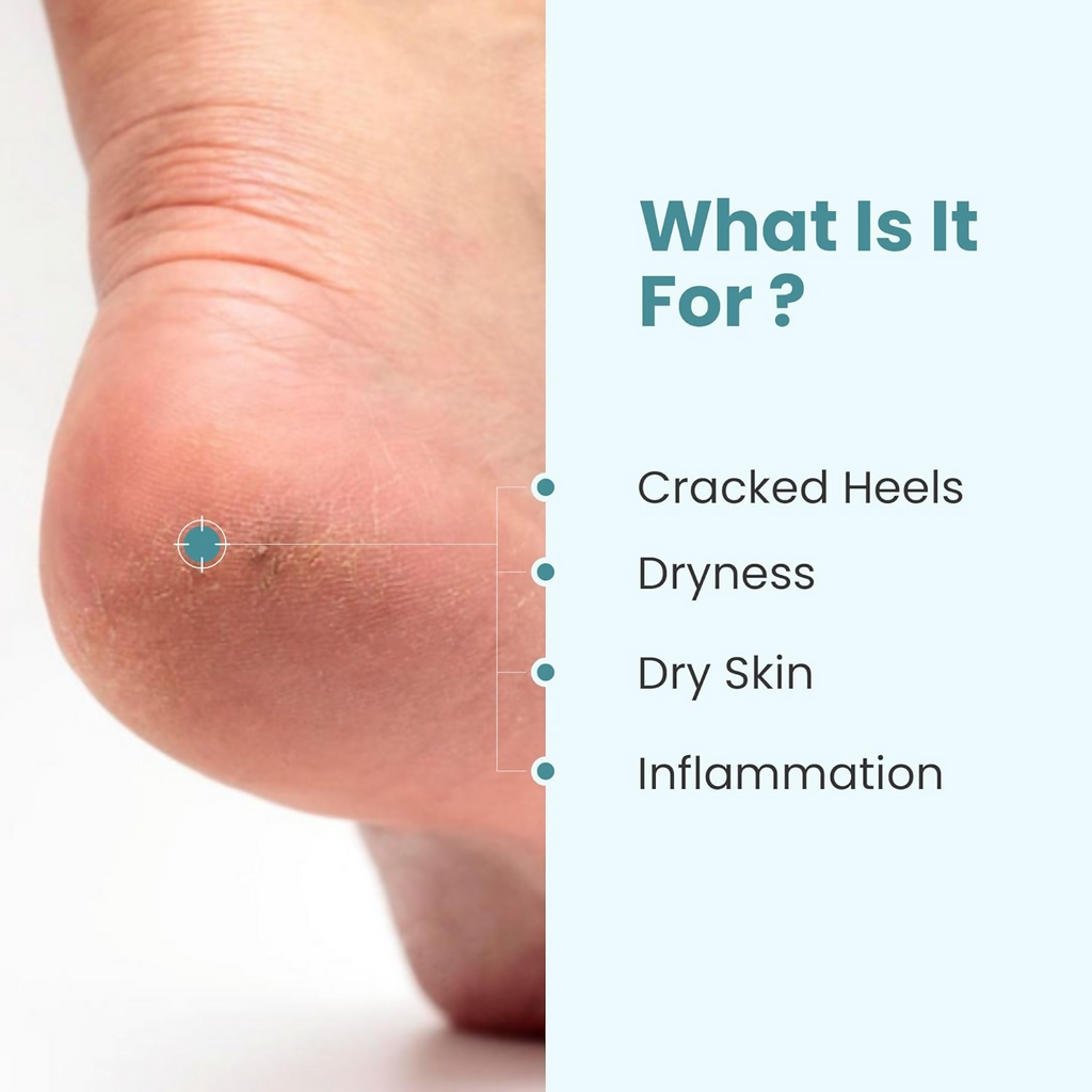 Uniqaya Foot Care Cream Repairs Cracked Heel | Grocsy