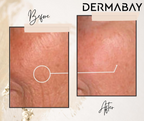 Dermabay Retinol 0.2% Face Serum | Grocsy