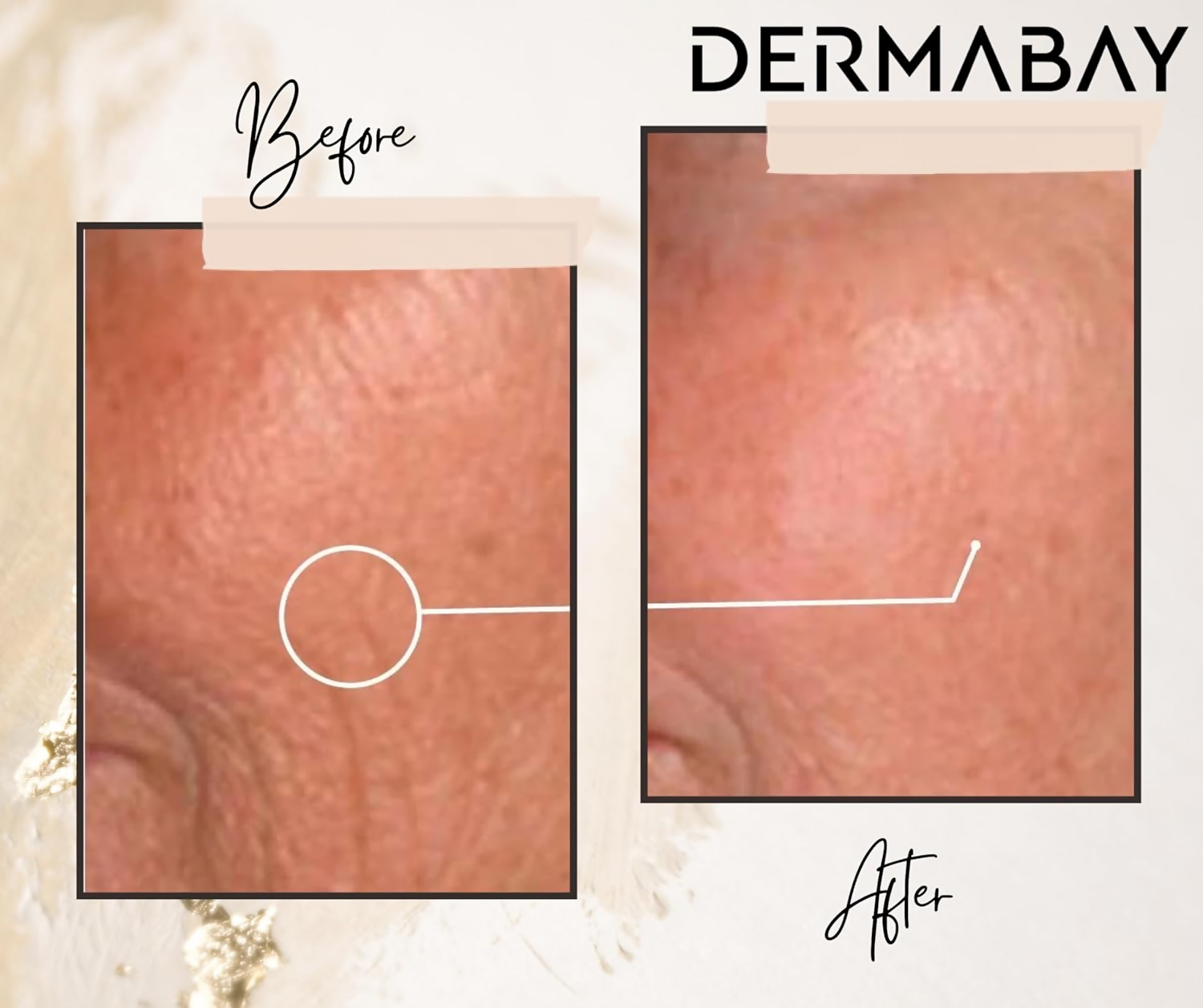 Dermabay Retinol 0.2% Face Serum | Grocsy