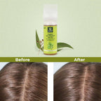 Organic Harvest Organic Anti Dandruff Hair Oil | Grocsy