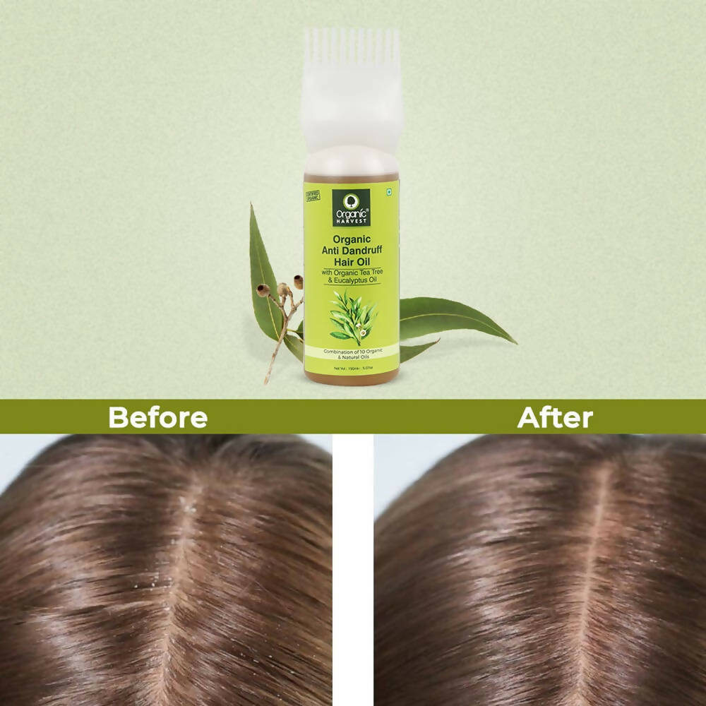 Organic Harvest Organic Anti Dandruff Hair Oil | Grocsy