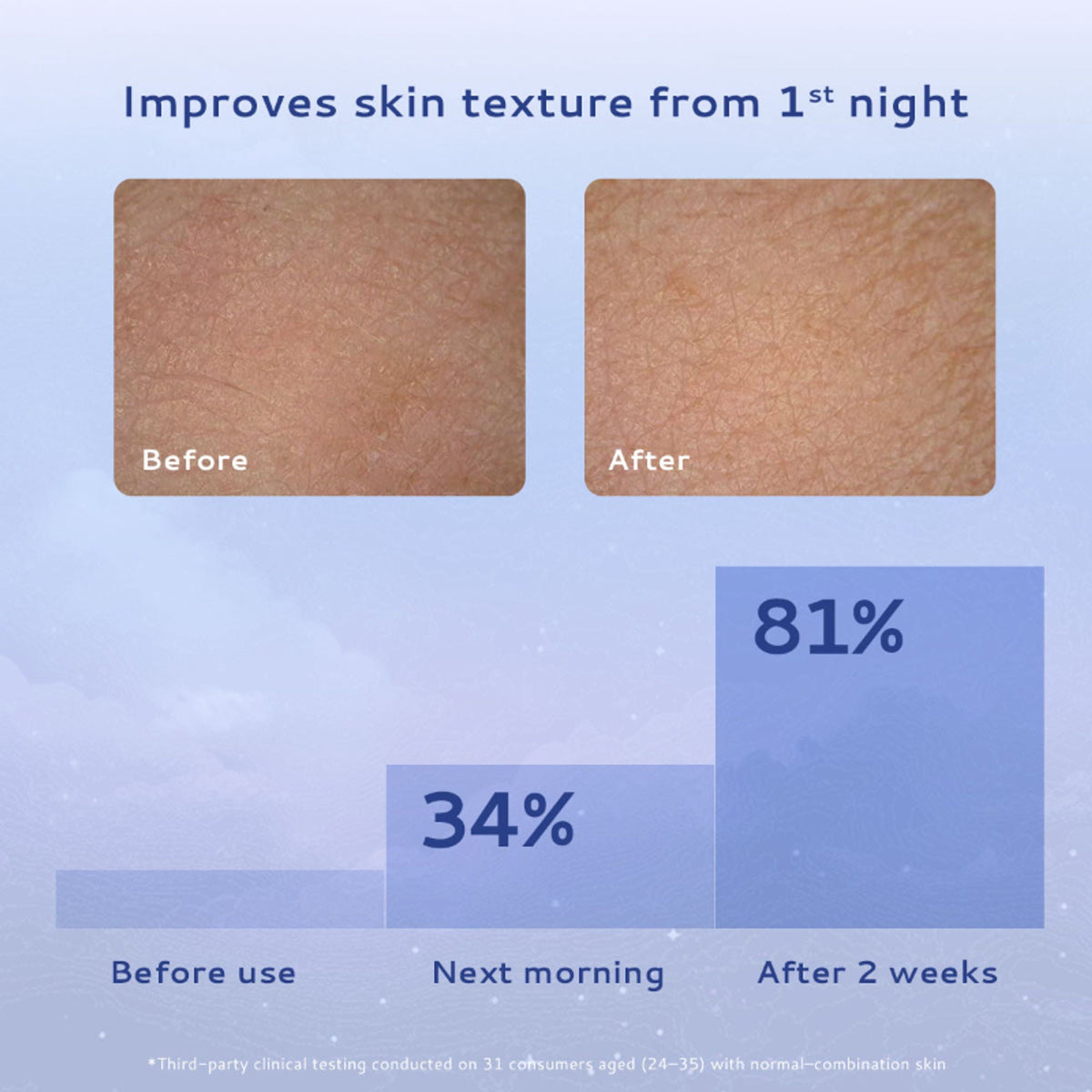 Lumineve Combination Skin Moisturizer with Niacinamide - Lightweight Gel For Oil-Free Hydration | Grocsy