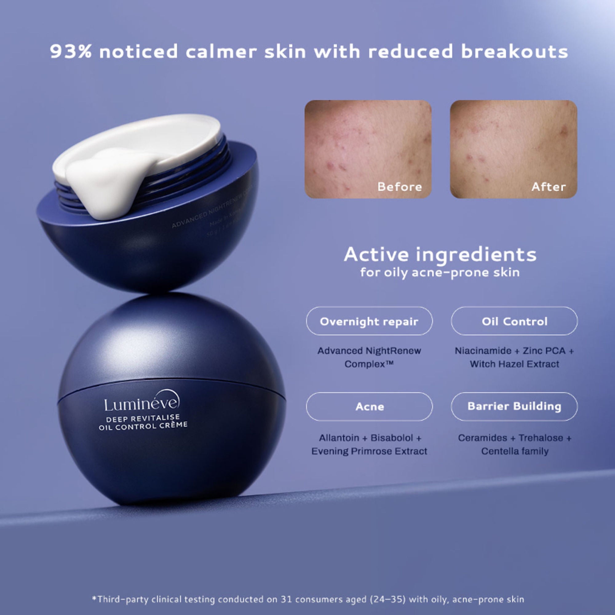 Lumineve Lightweight Moisturizer for Oily & Acne Prone Skin with Niacinamide for Hydrating Skin | Grocsy