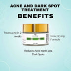 The Wellness Shop Acne and Dark Spot Treatment Cream | Grocsy