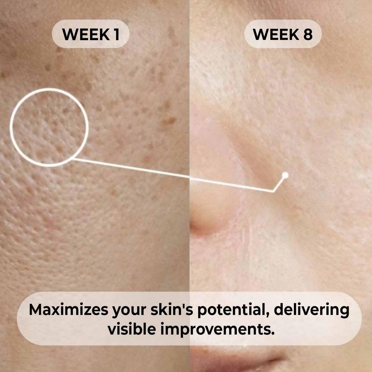 Dermabay Niacinamide 5%+ Hyaluronic acid 1% Serum | Grocsy