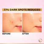L'Oreal Paris Glycolic Bright 8% [Melasyl + Niacinamide] Face Serum For Brightening Dark Spots | Grocsy