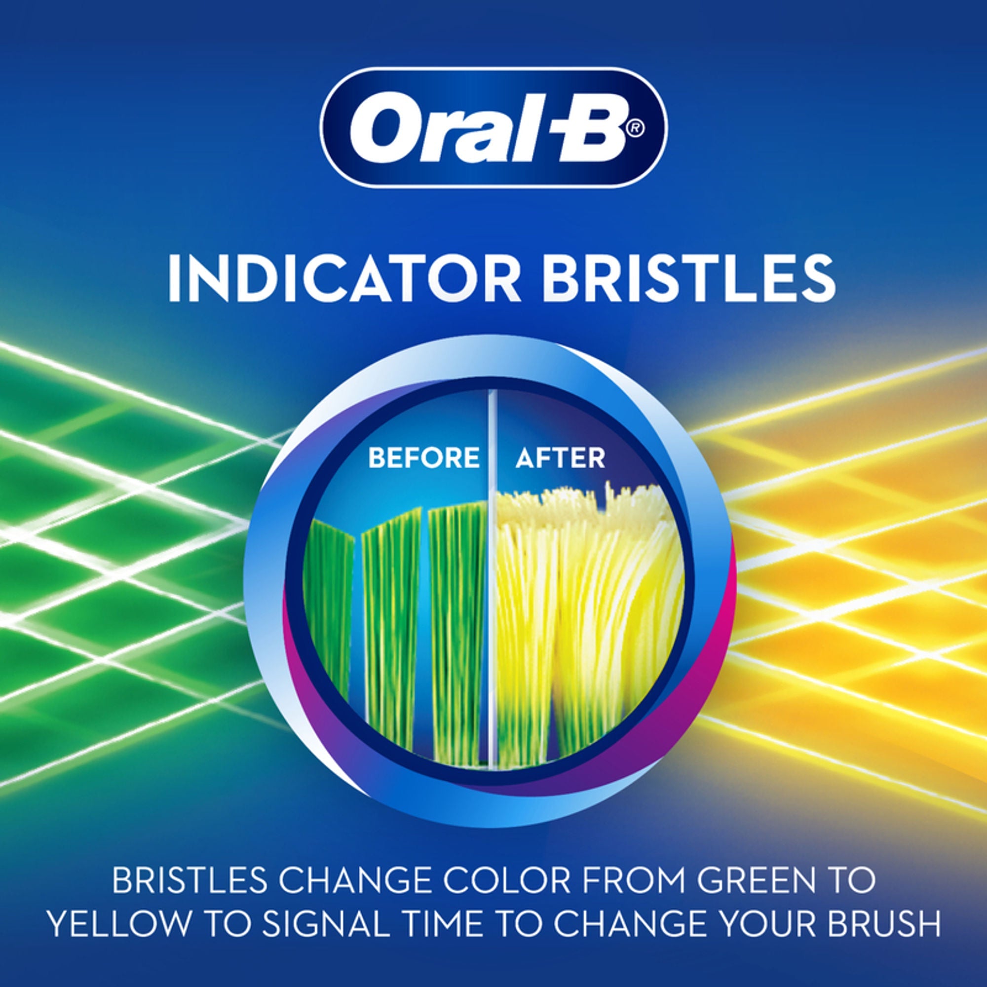 Oral-B Criss Cross Gum Care Toothbrush Pack Of 1 (medium) | Grocsy