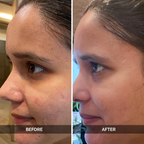 LuxaDerme Pore Perfecting Face Serum | Grocsy