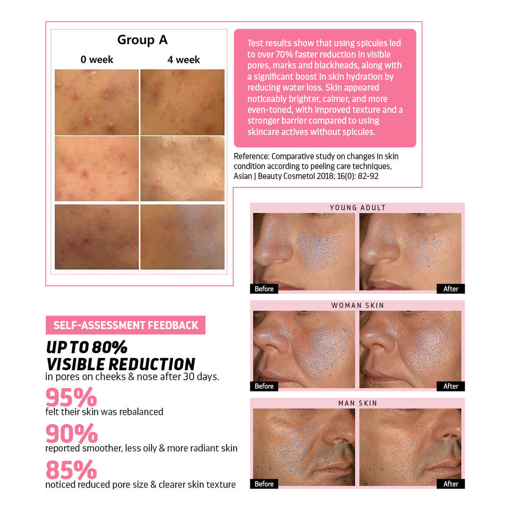 Indulgeo Essentials Cica Reedle Essence With PDRN | Grocsy