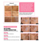 Indulgeo Essentials Cica Reedle Essence With PDRN | Grocsy