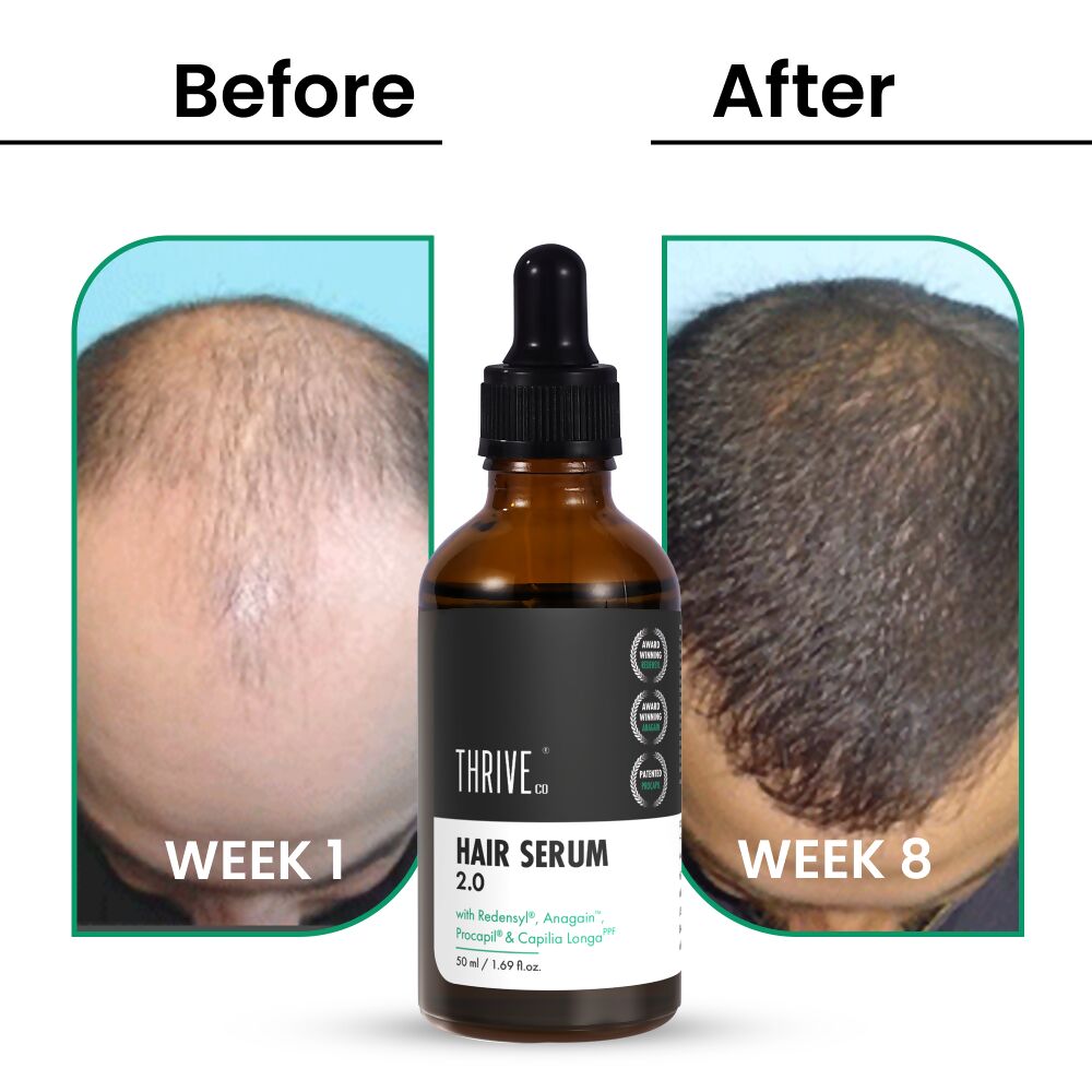 ThriveCo Hair Growth Serum 2.0 | Grocsy