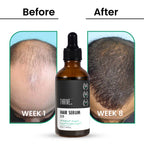 ThriveCo Hair Growth Serum 2.0 | Grocsy