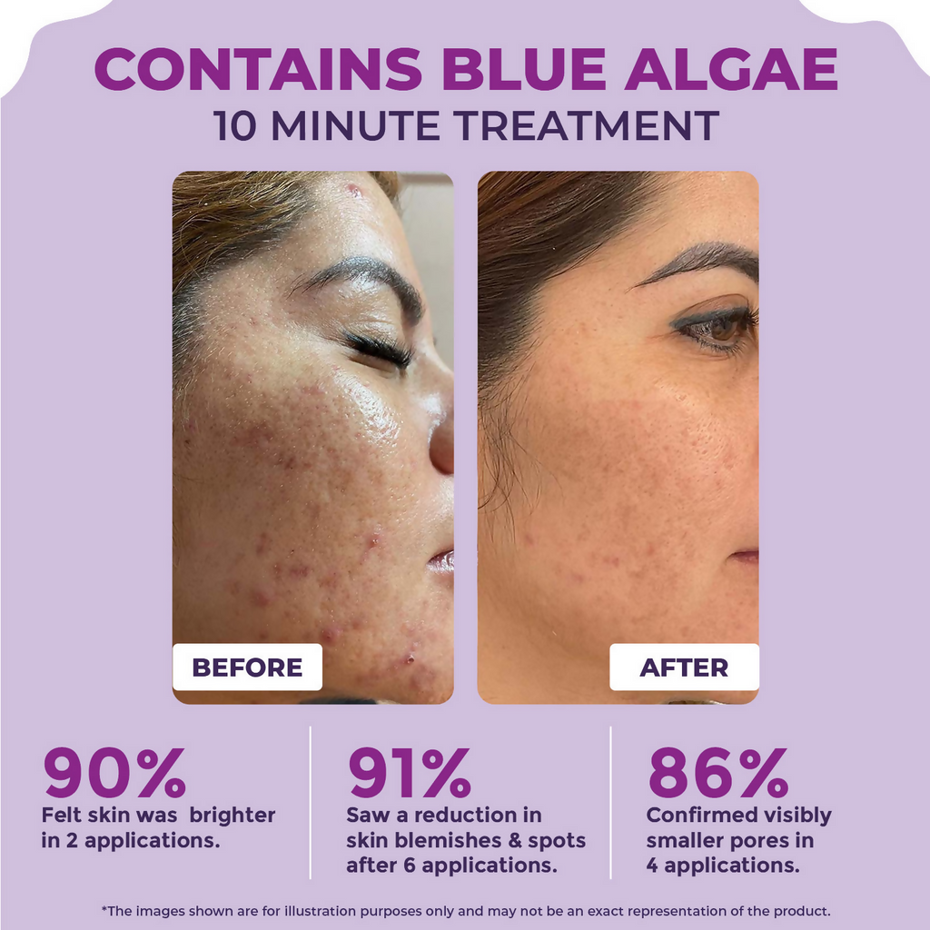 Sanfe 25% AHA + 2% BHA Exfloating Peeling Solution | Grocsy
