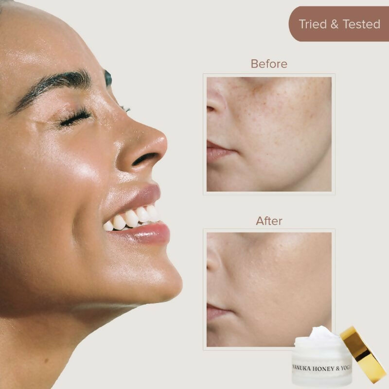 Dromen & Co Manuka Honey & Yoghurt Serum Moisturiser - Hydrates & Deep Nourishes, Reduces Wrinkles | Grocsy